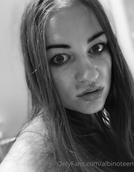 albinoteen